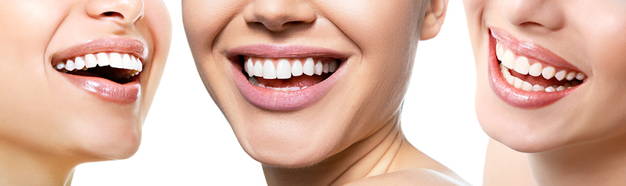 Trois sourires de femmes avec les dents blanches