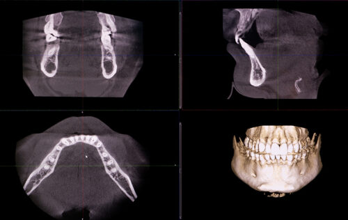 Radiographies dentaires et scan 3D d’une bouche